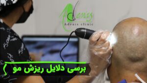 برسی دلایل ریزش مو و راهکار های کاشت مو