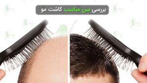 بررسی سن مناسب کاشت مو
