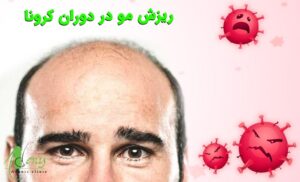 ریزش مو در دوران کرونا