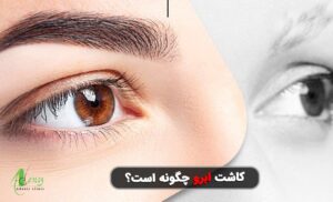 کاشت ابرو چگونه است؟