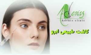 کاشت طبیعی ابرو