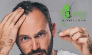 بهترین کاندیدای کاشت مو به روش HRT