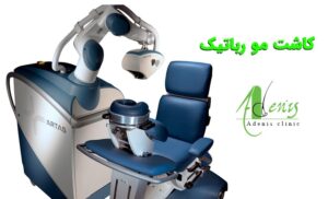 کاشت مو رباتیک