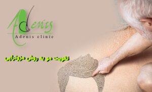تقویت مو به روش مزوتراپی