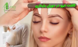 کاشت ابرو در دوران بارداری