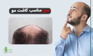 سن مناسب کاشت مو