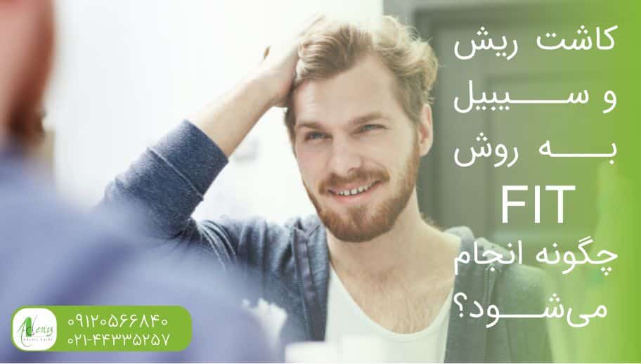 کاشت ریش و سبیل به روش FIT