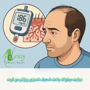 کاشت مو طبیعی افراد دیابتی