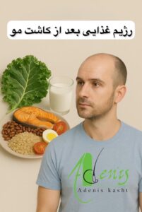 رژیم غذایی بعد از کاشت مو
