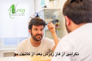 فاز ریزش مو کاشت شده