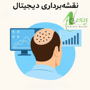 اسکن و آنالیز بانک مو