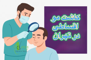 کاشت مو اقساطی در تهران