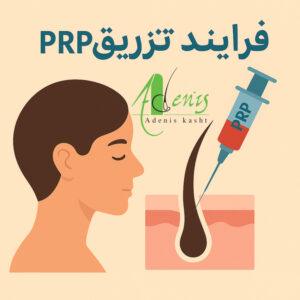 تزریق prp