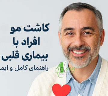 کاشت مو بیماران قلبی