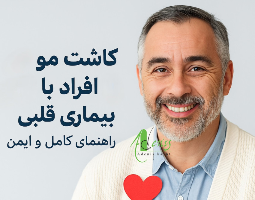 کاشت مو بیماران قلبی