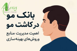 بانک مو 