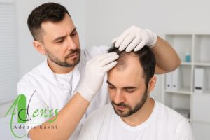 تیروئید و ریزش مو