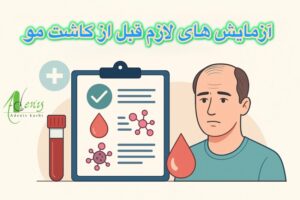 آزمایش های قبل از کاشت مو