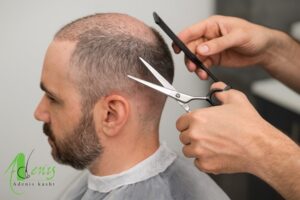 آرایشگاه بعد از کاشت مو