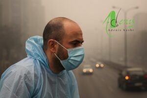آلودگی محیطی بعد از کاشت مو