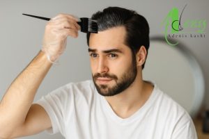 مو رنگ کردن بعد از کاشت مو