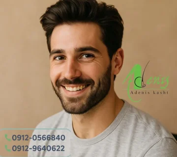 سن مناسب کاشت مو