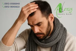 سرماخوردگی و کاشت مو