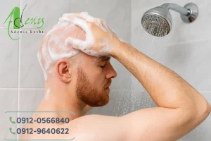 زیر دوش آب رفتن بعد از کاشت مو