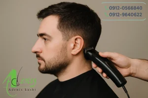 کچل کردن مو قبل از کاشت مو