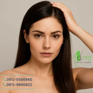 کاشت مو بانوان