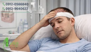 خستگی و بی حالی بعد از کاشت مو