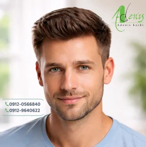 کاشت مو آقایان