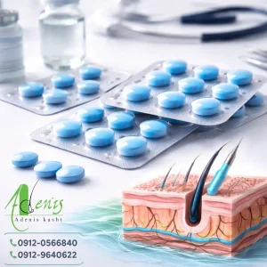 قرص سیلدنافیل و کاشت مو