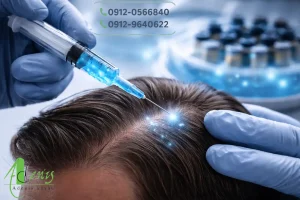 قطع ریزش مو با اگزوزوم تراپی