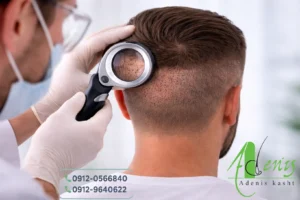 آیا بانک مو دوباره رشد میکند ؟