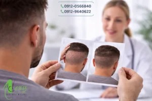 رشد مجدد موهای برداشت شده از بانک مو