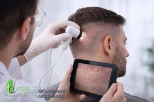 زمان ترمیم موهای بانک مو و رشد دوباره