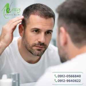 ممنوعیات بعد از کاشت مو