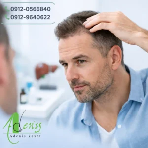 کاشت مو افراد کبد چرب و بررسی شرایط پزشکی