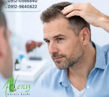 کاشت مو افراد کبد چرب و بررسی شرایط پزشکی