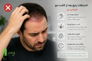 اشتباهات رایج مانند خاراندن سر که باعث تشدید سوزش بعد از کاشت مو می‌شود