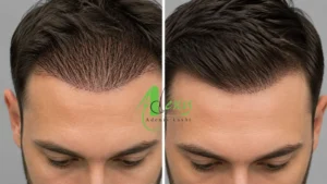 مقایسه خواب طبیعی و سیخ شدن موها